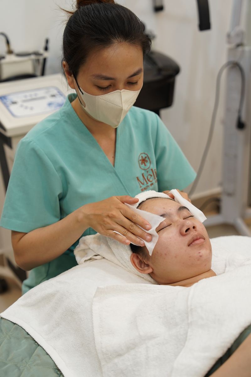 Trị mụn chuẩn y khoa tại Mélis